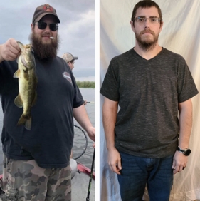 before and after photo