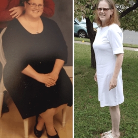 before and after photo