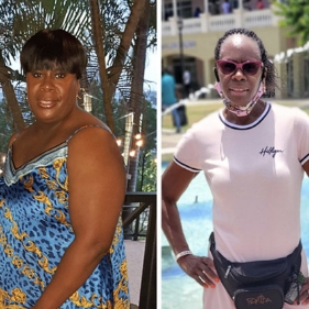 before and after photo