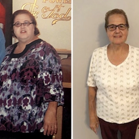 before and after photo