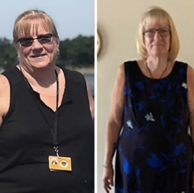 before and after photo