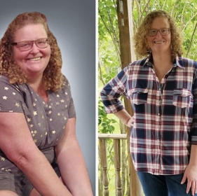 before and after photo