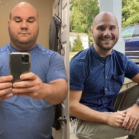 before and after photo