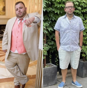 before and after photo