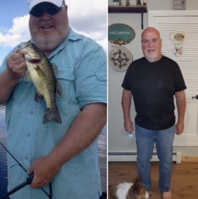 before and after photo