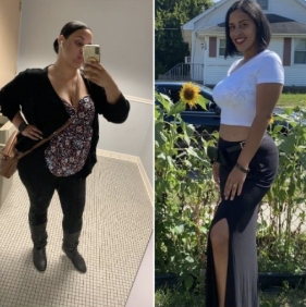 before and after photo