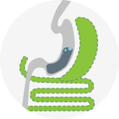 Duodenal Switch Surgery icon
